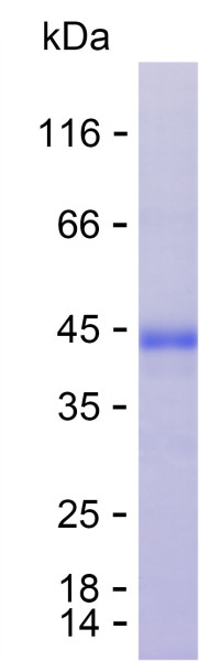 Recombinant Human CHST14 Protein