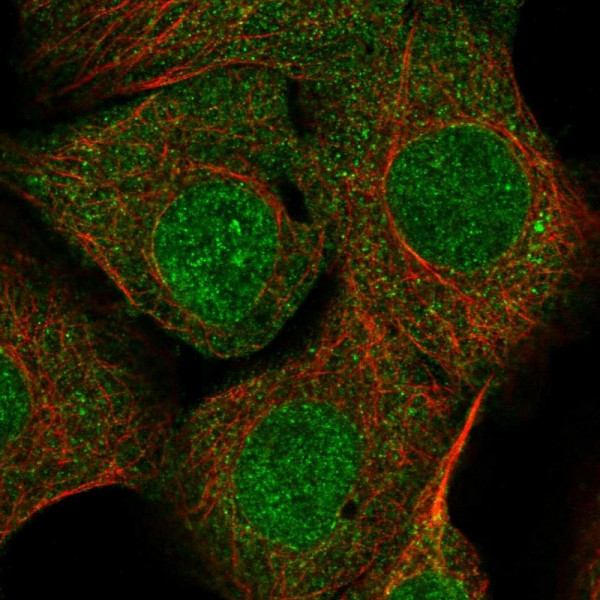 Anti-SDCBP