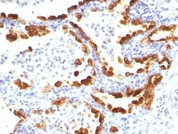 Anti-Cytokeratin 18, clone KRT18/835