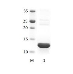 DFNB31_3 PDZ Domain