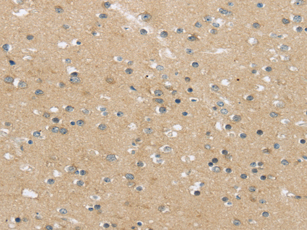 Anti-MPP6