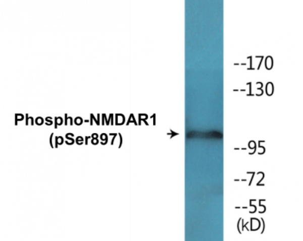 NMDAR1 (Phospho-Ser897) Colorimetric Cell-Based ELISA Kit