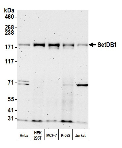 Anti-SETDB1