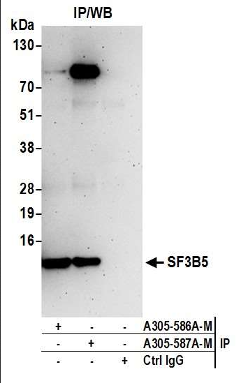 Anti-SF3B5