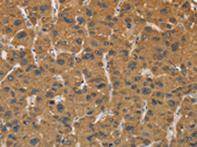 Anti-CYP17A1