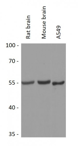 Anti-METTL4