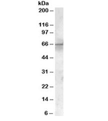 Anti-PDK1