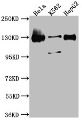 Anti-BUB1 Recombinant Monoclonal, clone 9C11