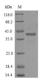 Atypical chemokine receptor 1 (ACKR1) (Active), human, recombinant