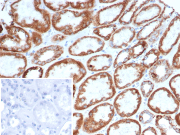 Anti-CD269 / TNFRSF17 / BCMA (B-Cell Maturation Protein), clone BCMA/7253