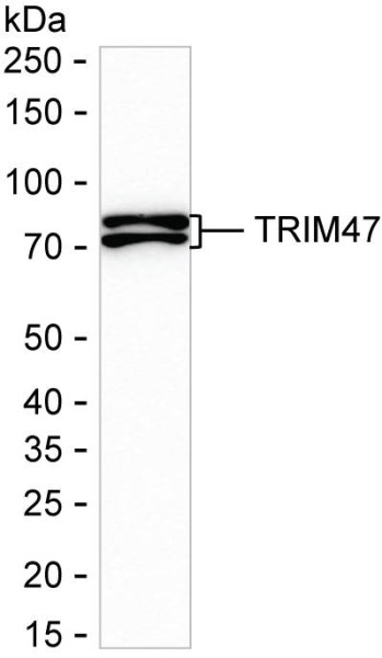 Anti-TRIM47