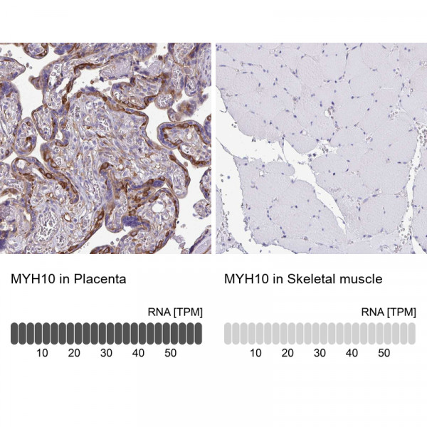 Anti-MYH10