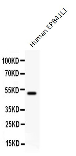 Anti-EPB41L1 / 4.1N