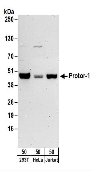 Anti-Protor-1