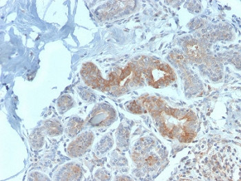 Anti-MVP / Major Vault Protein, clone VP2897R