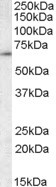 Anti-CCT3 / TCP1, C-terminal