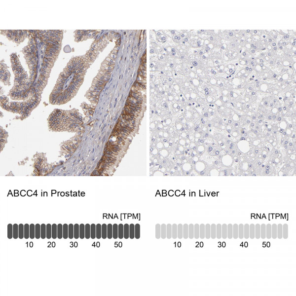 Anti-ABCC4