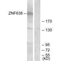 Anti-ZNF638