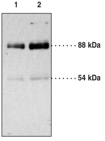 Anti-CD36