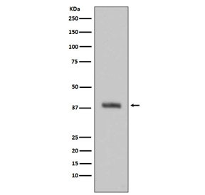 Anti-TGN46 / TGOLN2, clone AOHO-20