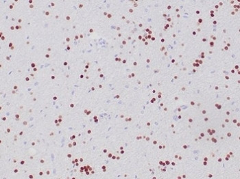 Anti-OLIG2, clone OLIG2/6695R