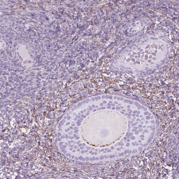 Anti-GDF9