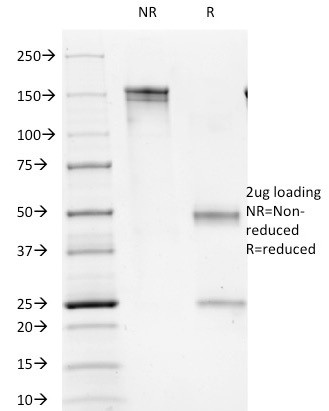 Anti-CD1b (T-Cell Surface Glycoprotein), clone 100-1A5