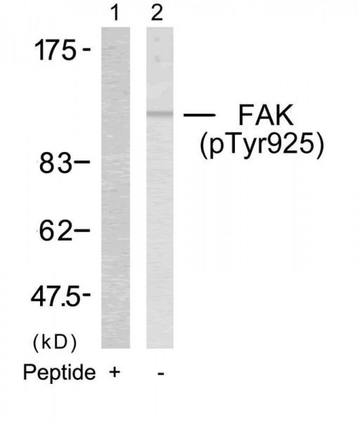 Anti-phospho-FAK (Tyr925)