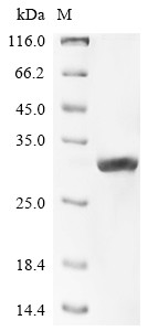 Carbamoyl-phosphate synthase [ammonia], mitochondrial (Cps1),partial, mouse, recombinant