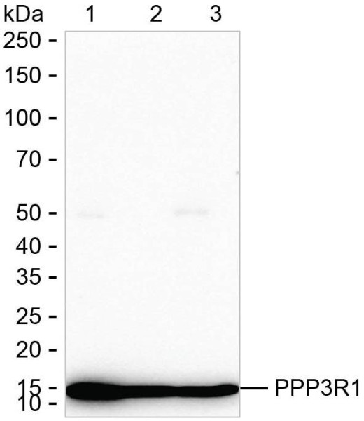 Anti-PPP3R1