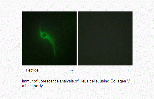 Anti-Collagen V alpha1