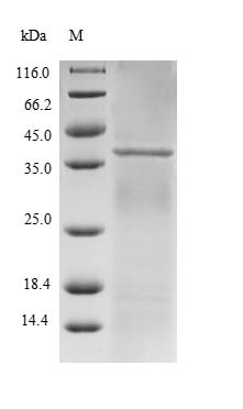 E3 SUMO-protein ligase RanBP2 (RANBP2), partial, human, recombinant