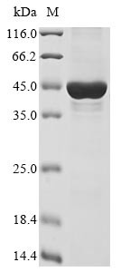 Inactive histone-lysine N-methyltransferase 2E (KMT2E), partial, human, recombinant
