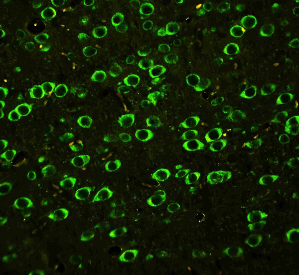 Anti-ABI1 / SSH3BP1