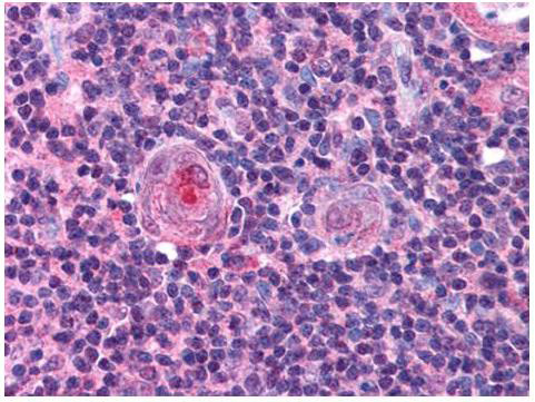 Anti-NF-Y beta (NF-YB)