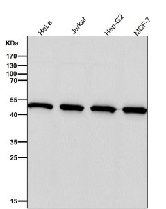 Anti-PSMC4 / 26S proteasome regulatory subunit 6B / TBP-7, clone 31P63
