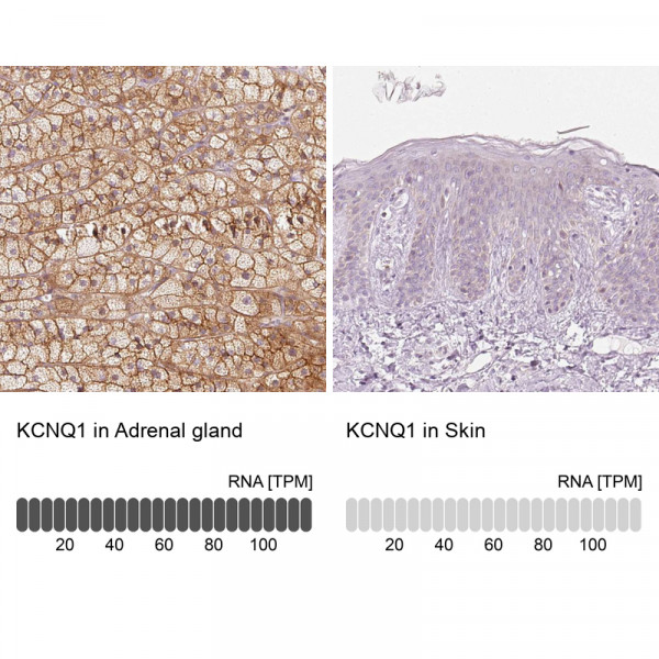Anti-KCNQ1