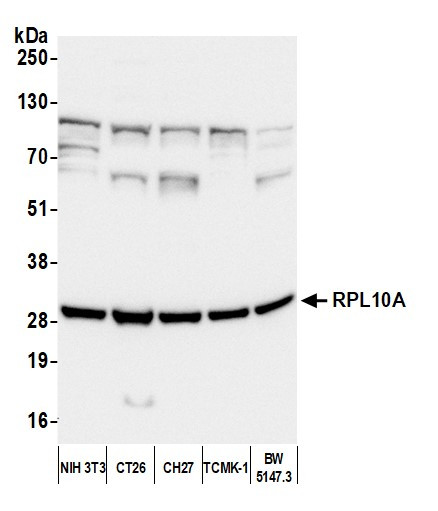 Anti-RPL10A/Ribosomal Protein L10a