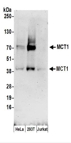 Anti-MCT1