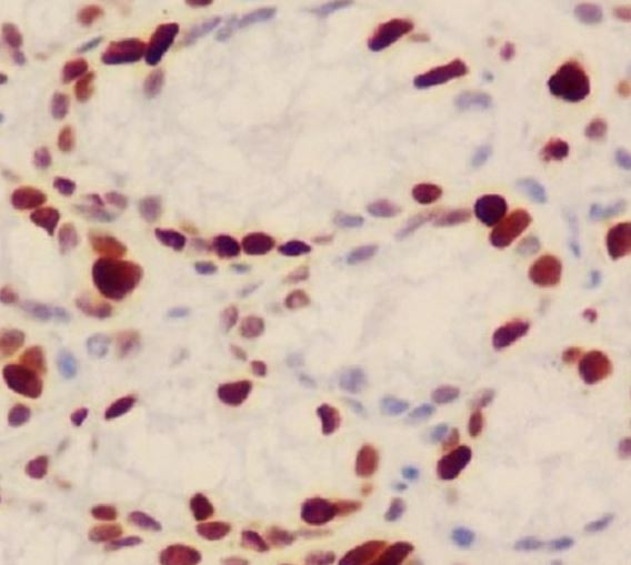 Anti-phospho-Histone H1.3 + H1.4 (Thr17)