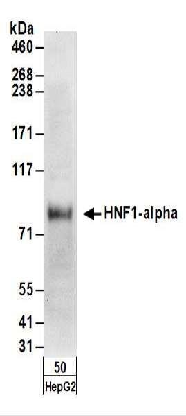 Anti-HNF1-alpha