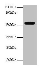 Anti-MMP3