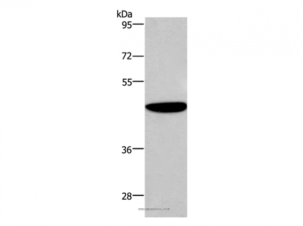 Anti-ABI1