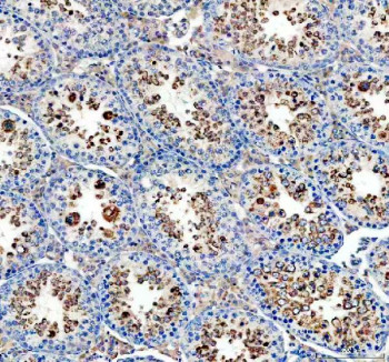 Anti-GPX4 / Glutathione Peroxidase 4