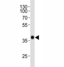 Anti-SOX2, clone 57CT23.3.4