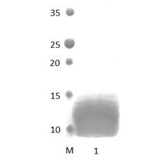 NHERF3_4 PDZ Domain