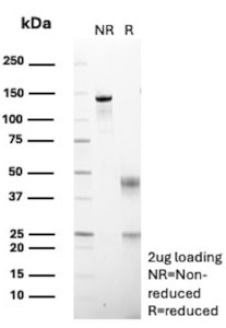 Anti-DBC2 / Deleted in breast cancer gene 2 / RHOBTB2, clone DBC2/12581