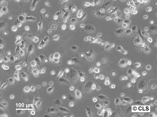 RCC-HB Cells