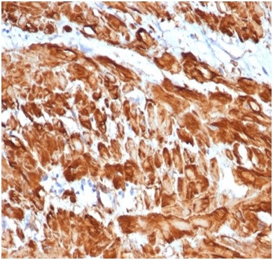 Anti-Actin, Smooth Muscle (Leiomyosarcoma Marker), recombinant antibody, clone rACTA2/1625