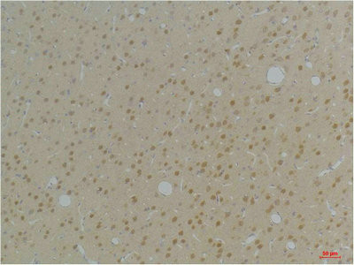 Anti-KCNAB1